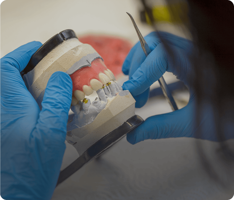 Dental prosthetic preparation process