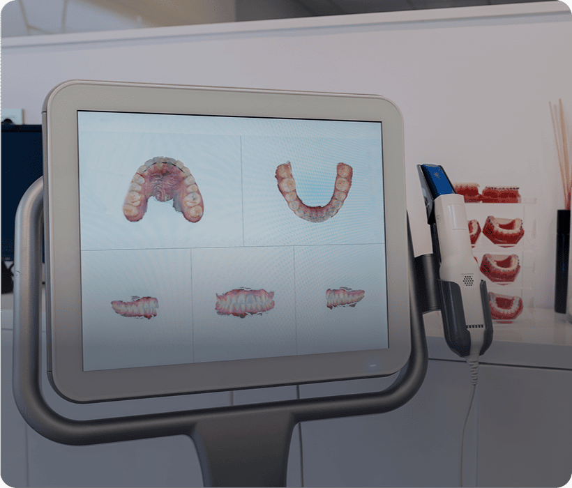 3D dental imaging display