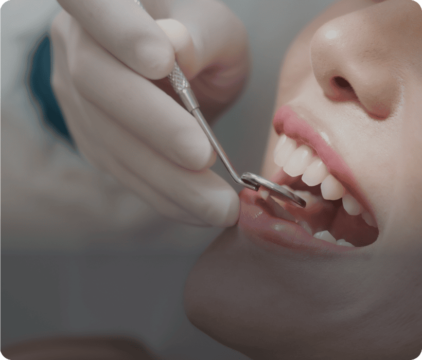 Close-up of dental check-up