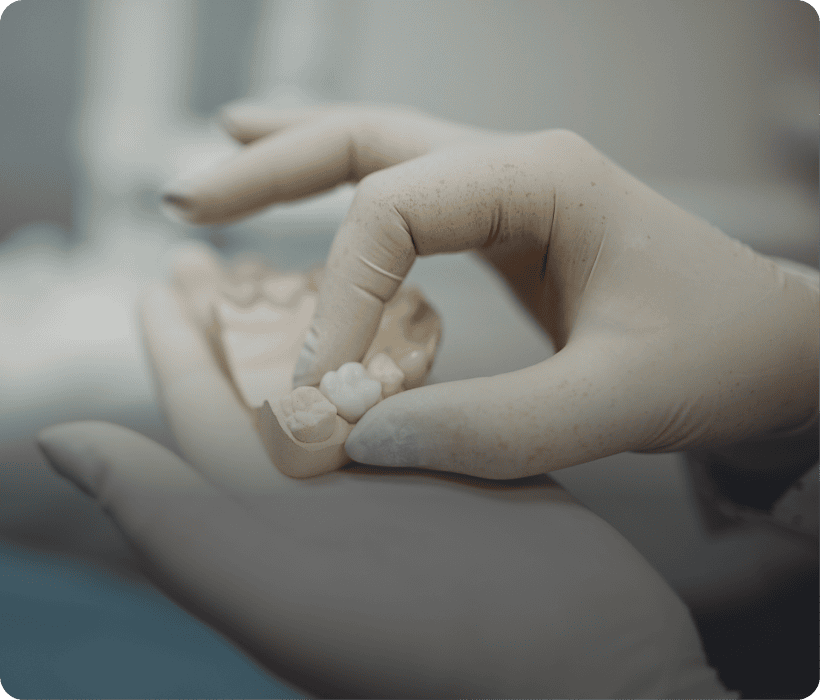 Gloved hand holding dental mold