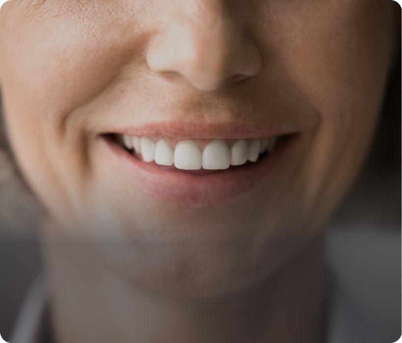 Smiling person showing white teeth