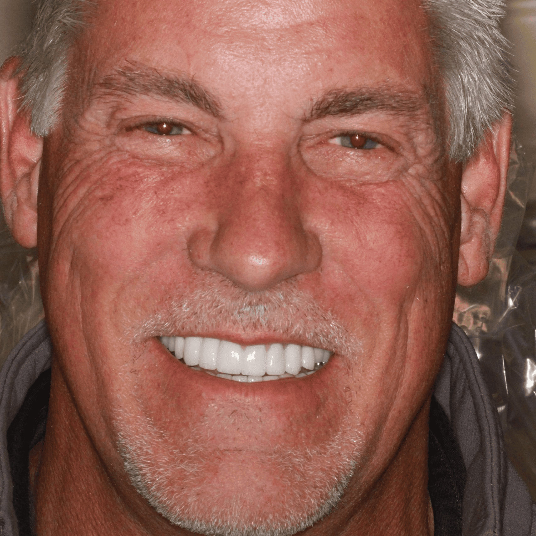 Happy man with bright white teeth.
