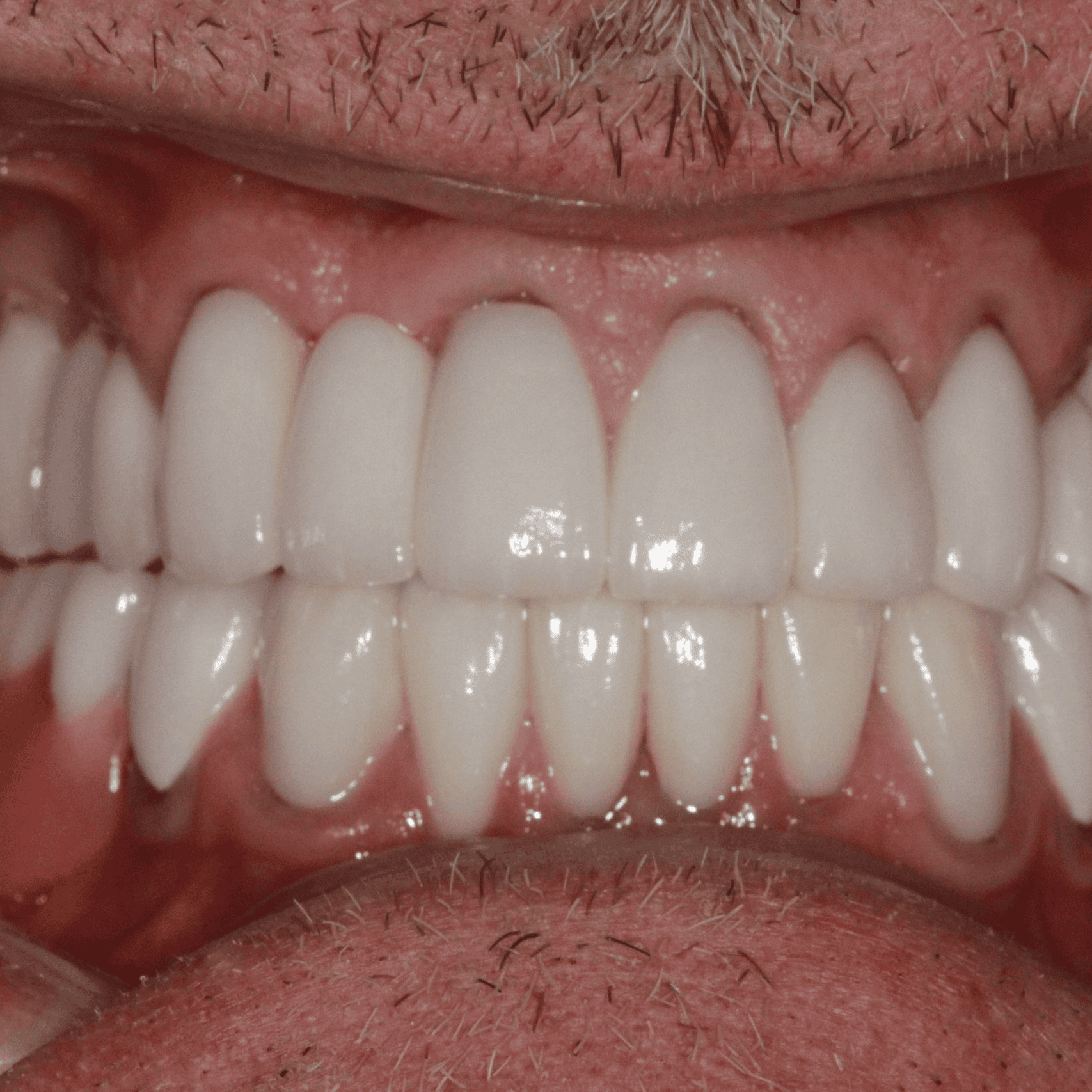 Close-up of a set of teeth