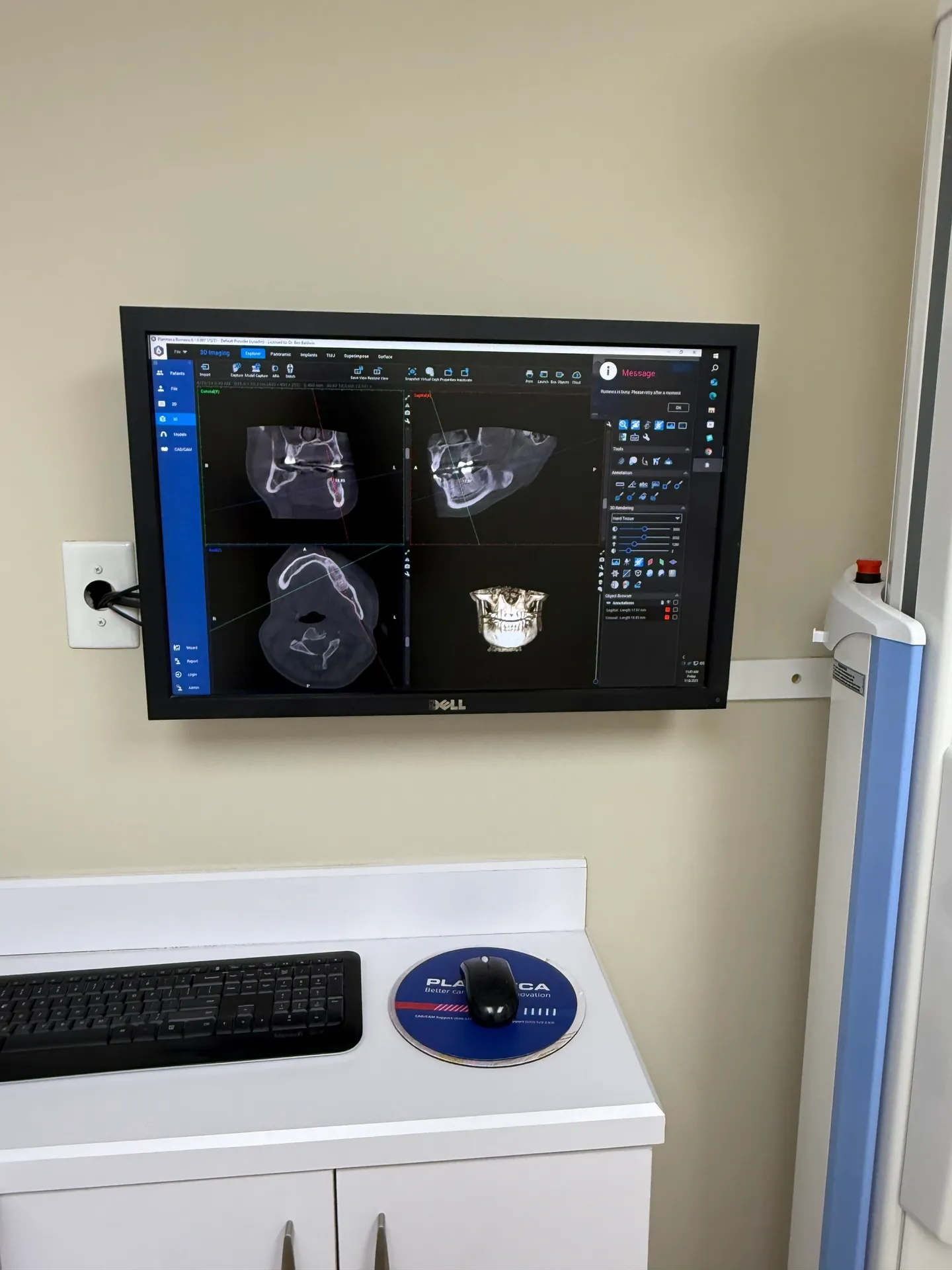 Computer showing dental scans and images.