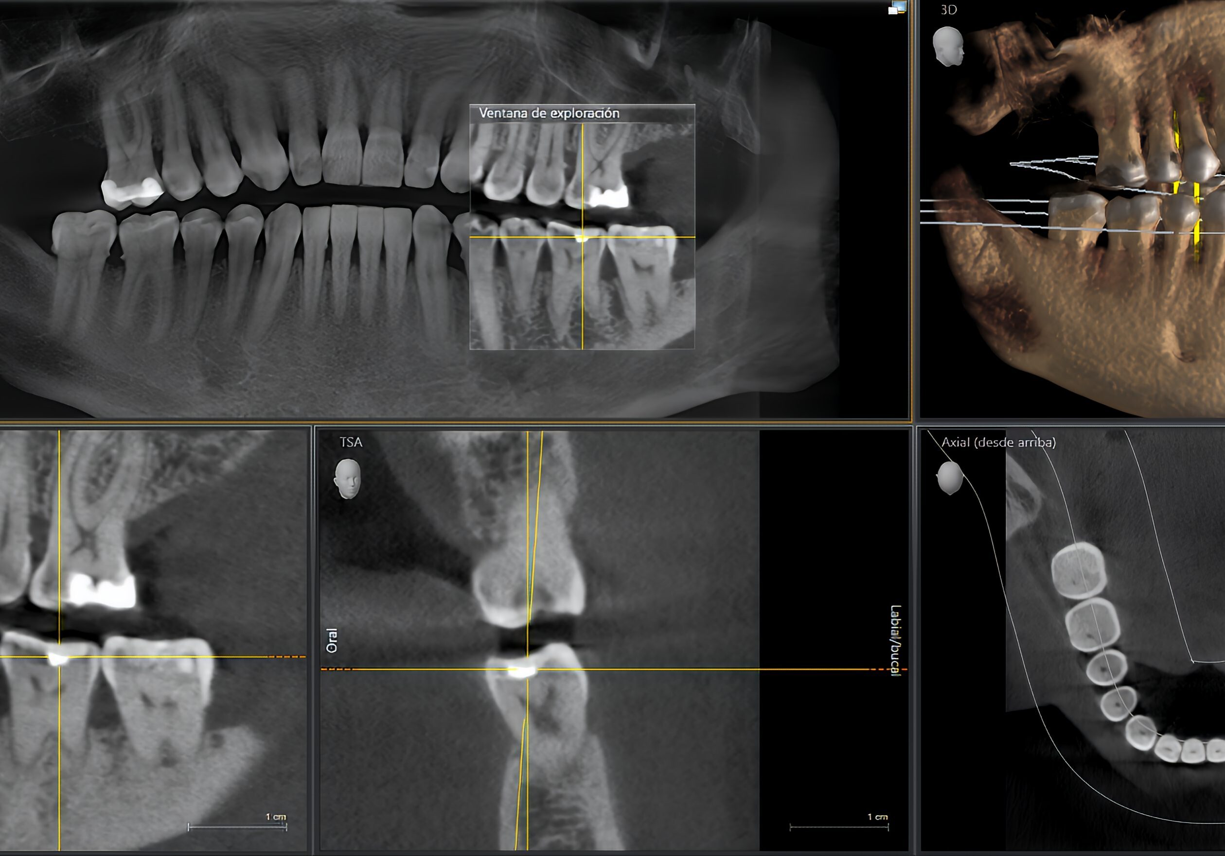 Dental practitioner reviewing a comprehensive cone beam computed tomography scan of a patient's jaw, aiding in treatment planning